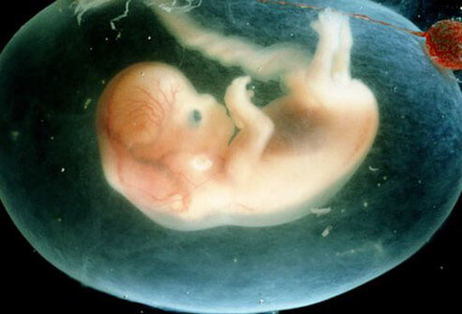 Surgical Abortion &#8211; Genesis Pregnancy Support